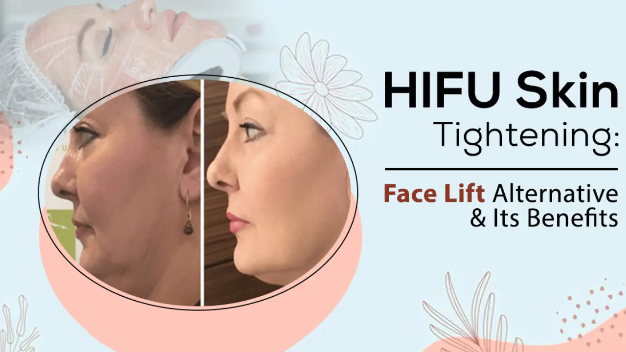 HIFU Treatment Effective Way to Improve Your Skin and Health